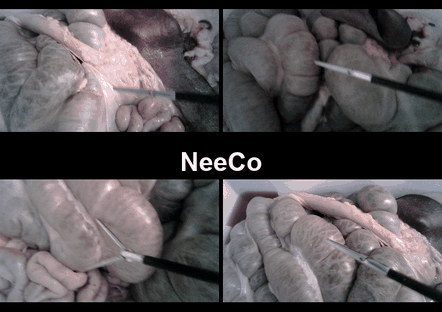 NeeCo